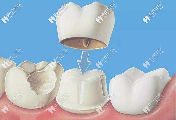 烏市做牙齒治療的收費參考