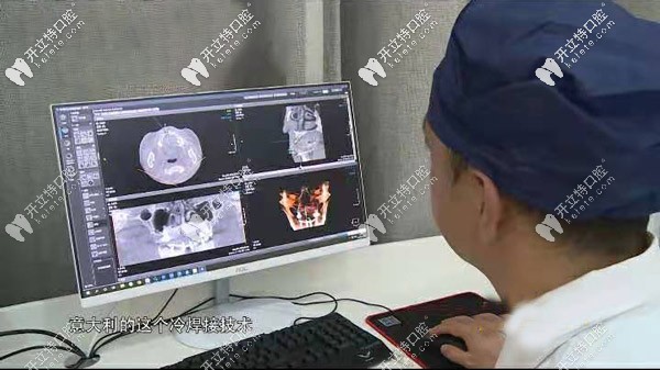 采用意大利冷焊接技術(shù)