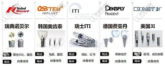 不同品牌種植體的特點(diǎn)和壽命