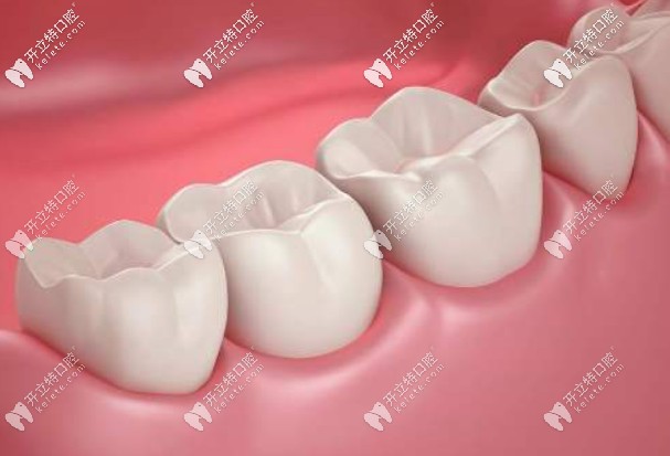 國(guó)產(chǎn)的滬鴿美晶瓷和瓷倍健哪個(gè)好？?jī)r(jià)格各是多少？