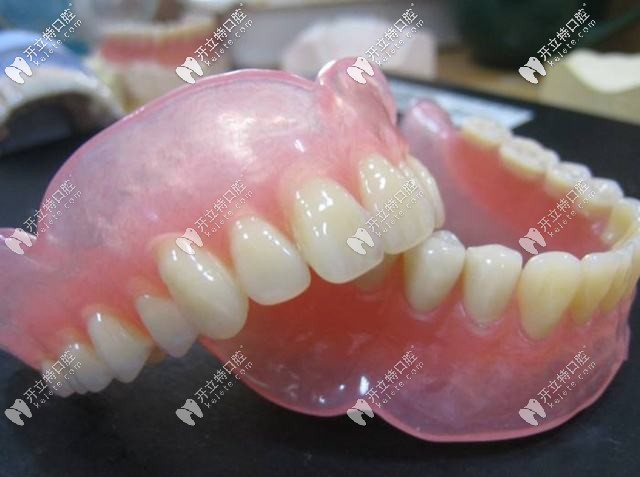 活動義齒修復(fù) 活動義齒修復(fù)