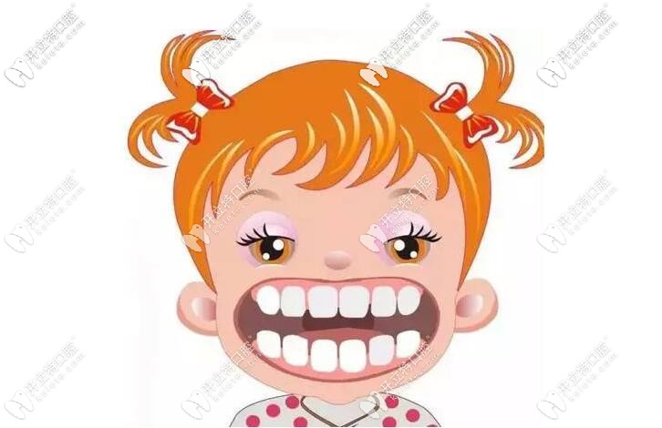 兒童早期矯正的必要性