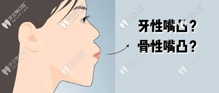 齙牙矯正可以改善凸嘴