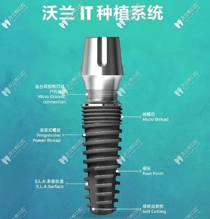 士卓曼合作的沃蘭IT種植體——更適合上頜前牙區(qū)的缺失哦