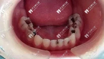 延吉韓世口腔醫(yī)院貴嗎?中等偏低!百康特2645元起,廠商直供