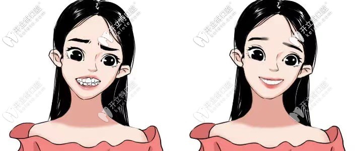 整完牙都變漂亮了呢！