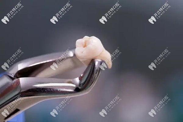 高血壓拔牙有什么風(fēng)險(xiǎn)