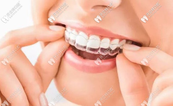 聽說國外建議戴著隱形牙套吃東西,那不會磨損矯正器嗎？