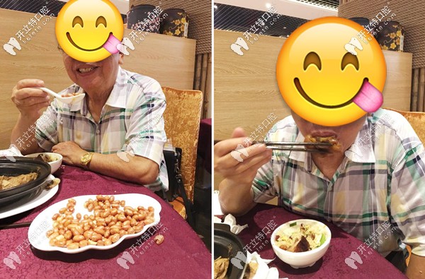 張伯做完種植牙后的生活照 張伯做完種植牙后的生活照