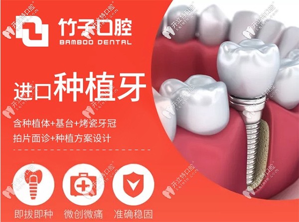 進(jìn)口種植牙8120元起