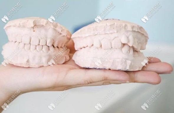 忻州牙齒矯正價格參考