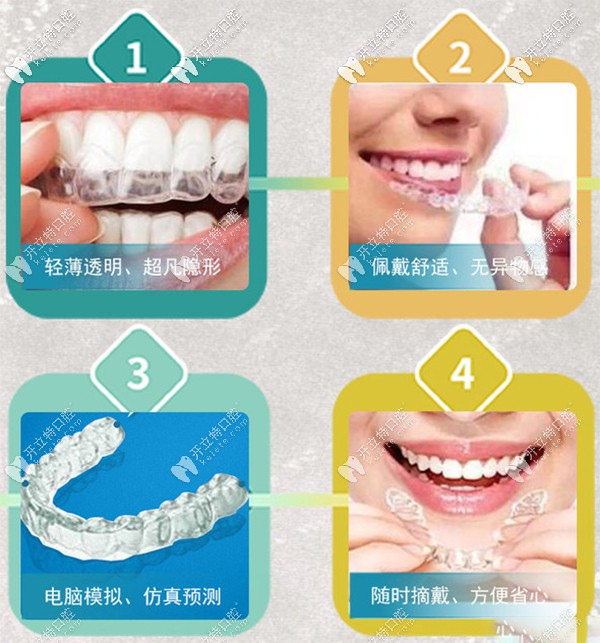 做隱形矯正優(yōu)勢