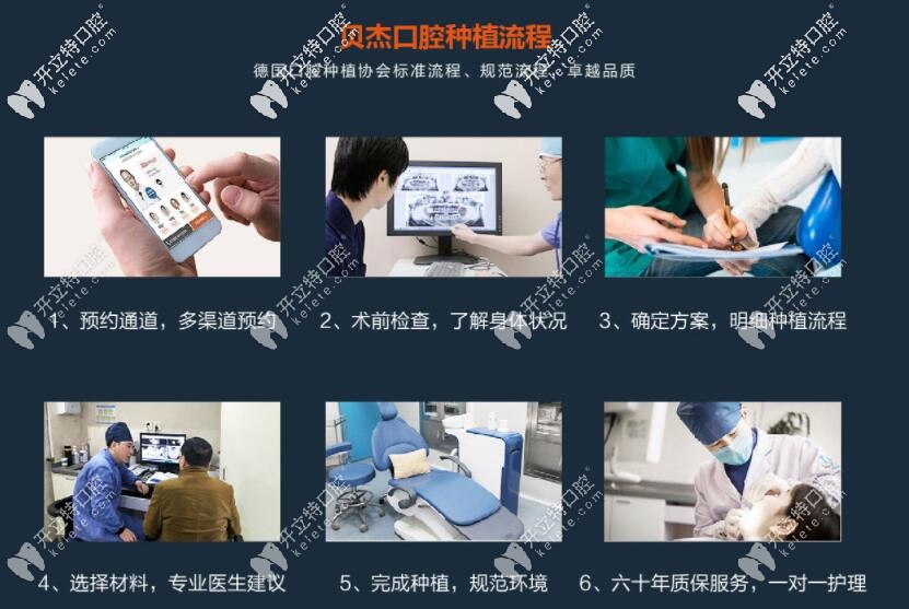 貝杰種植牙流程 貝杰種植牙流程