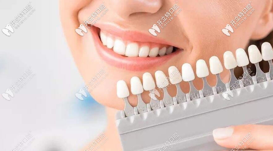 牙齒顏色對(duì)照表怎么看,深度剖析各種牙齒顏色