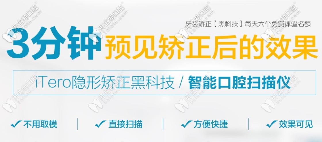 itero口掃 itero口掃