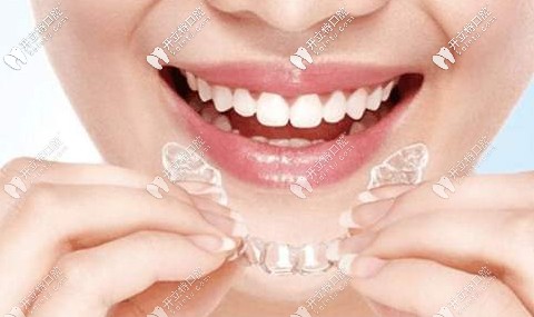 隱形牙套