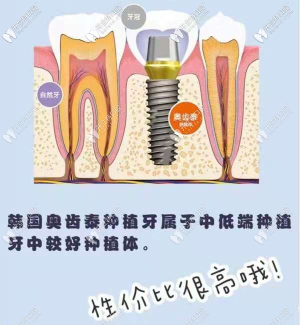 長沙韓德口腔做韓國奧齒泰優(yōu)惠