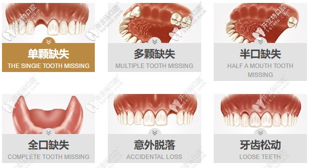 找這份合肥貝杰口腔做種植牙的價(jià)格表不容易，請(qǐng)珍惜~