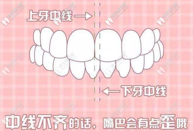 偏頜可以矯正嗎