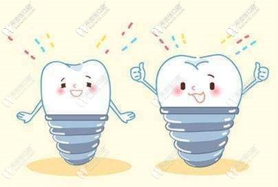 合肥各口腔醫(yī)院做種植牙多少錢一顆？真實(shí)收費(fèi)標(biāo)準(zhǔn)揭曉！