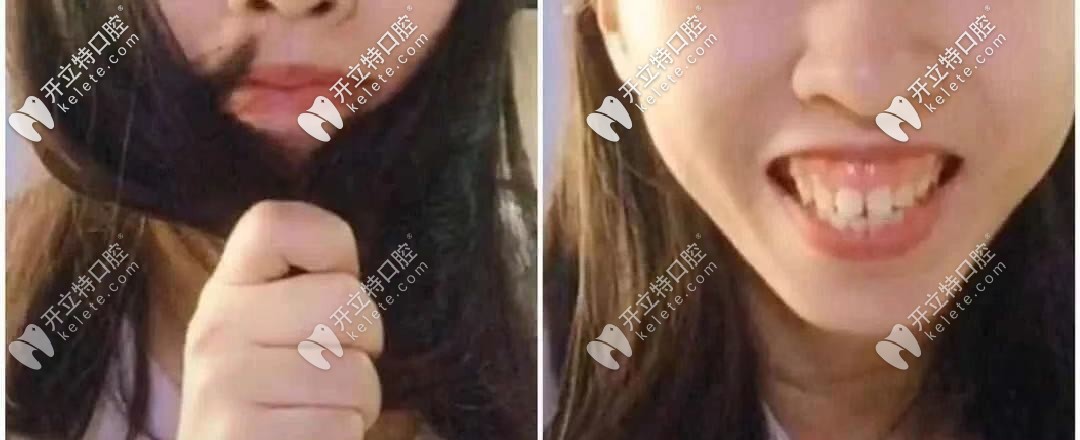 顏值是否也被封??？