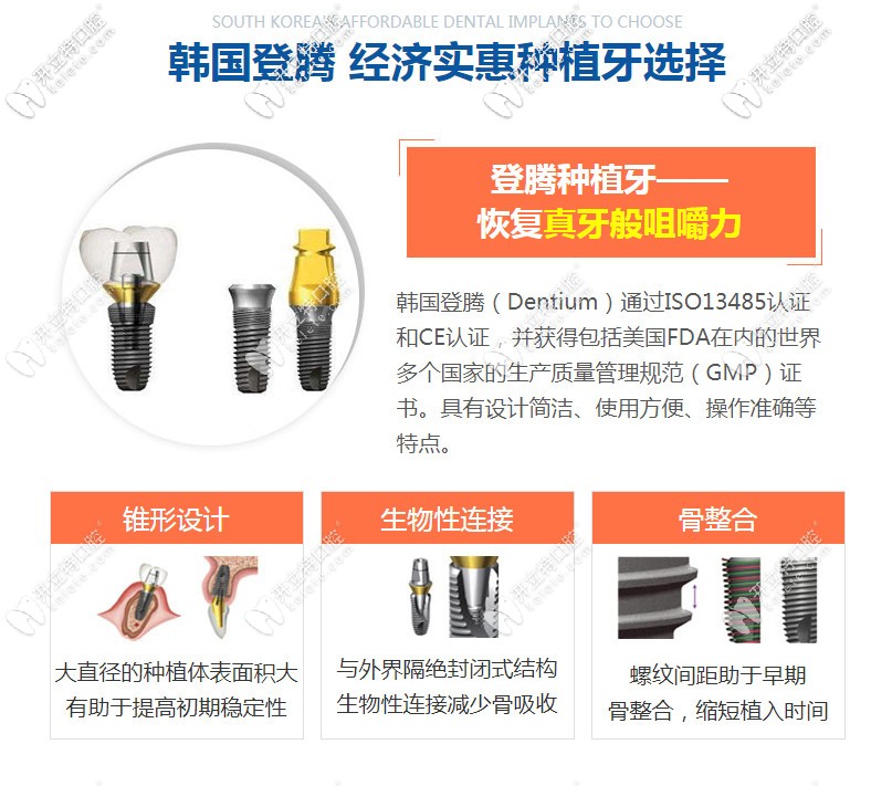 韓國登騰種植牙