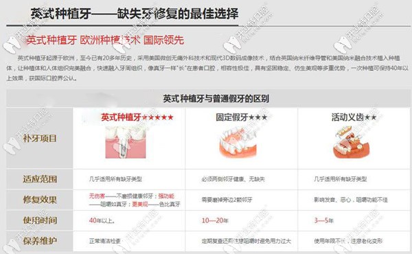 青島牙博士口腔英式種植牙技術(shù)