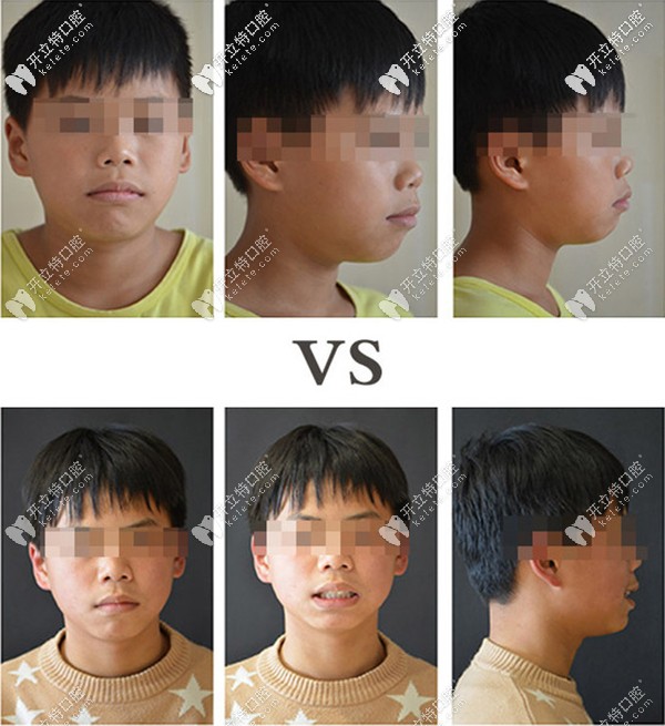 昆明牙科醫(yī)院哪家好且價格便宜?昆明10家平價口腔含柏德