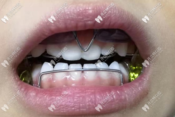 龐瑀醫(yī)生的擅長項目