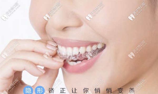 看到煙臺芝罘區(qū)德韓口腔全隱形數(shù)字矯正的價(jià)格,我不淡定了