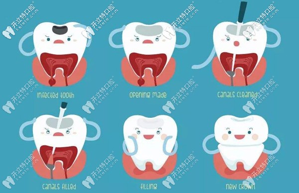 聽說牙疼會引起發(fā)燒,那牙痛發(fā)燒該如何處理呢？