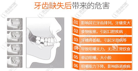 種植牙將被再生牙取代?基因再生牙齒臨床仍遙遙無期