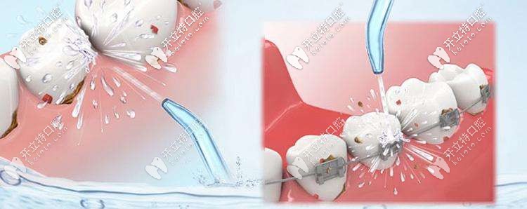 半年洗一次牙，保持牙齒健康