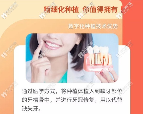 昆明竹子口腔做瑞典Astra即刻種植牙怎么樣？真實(shí)評(píng)價(jià)來(lái)襲