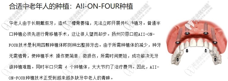 all on 4種植牙介紹