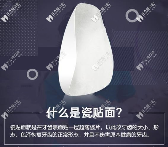 什么是牙貼面？