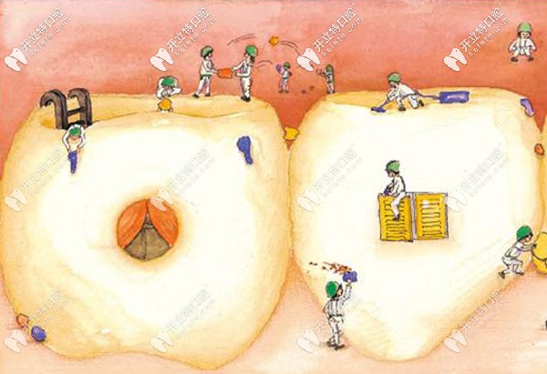 6000元、8000元、9000元甚至上萬(wàn)元的種植牙有沒(méi)有區(qū)別