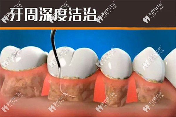 丹麥水冷激光患者評價