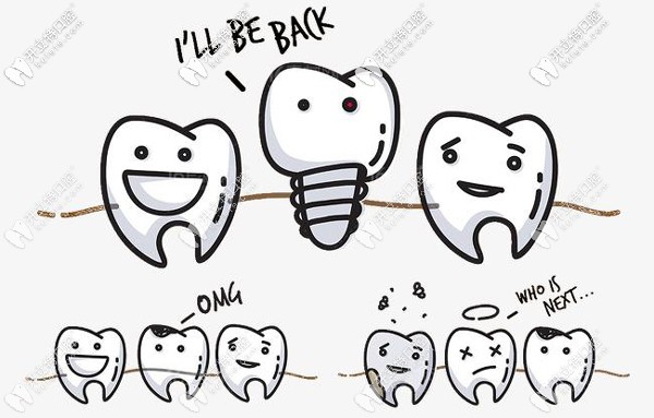 韓國(guó)登騰Dentium種植體