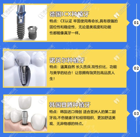 各品牌種植牙不同優(yōu)勢