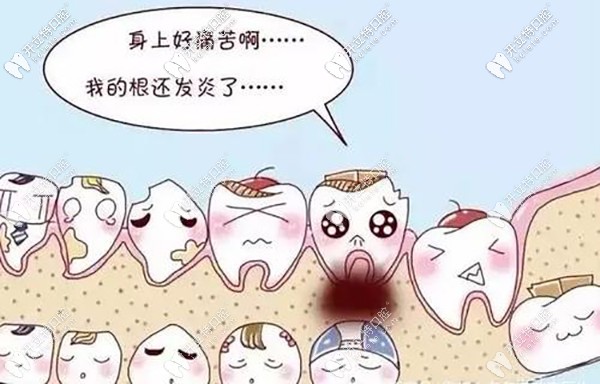 再和你聊聊發(fā)炎和干槽癥的區(qū)別？干槽癥前兆是啥樣？