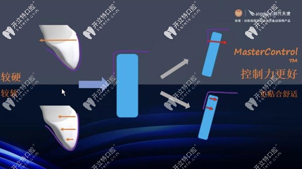 抗蠕變性強(qiáng)的材料，可以更加的控制牙齒