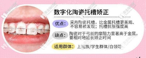 半隱形陶瓷矯正器的優(yōu)勢