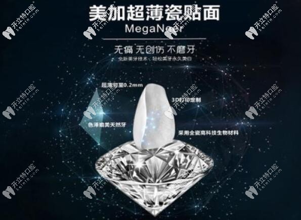 美加超薄瓷貼面