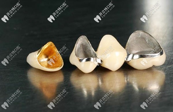 烤瓷牙的材質(zhì)