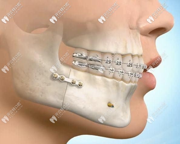 曲靖第一人民醫(yī)院口腔科價(jià)格表!種植牙5800元,門(mén)診4樓掛號(hào)