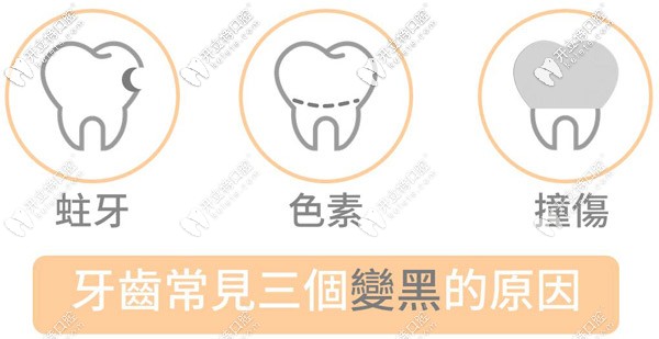 兒童牙齒黑斑是什么原因引起的，需要治療嗎？