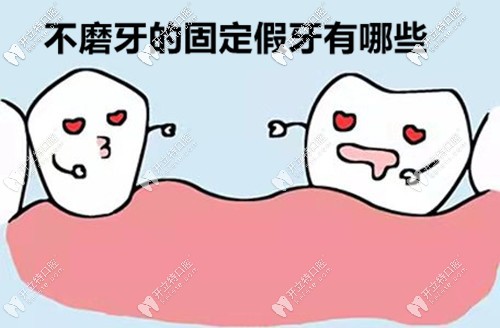 不磨鄰牙的固定假牙都有哪些種類?據(jù)說(shuō)套筒冠義齒也在內(nèi)