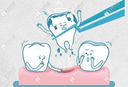 拔牙項(xiàng)目