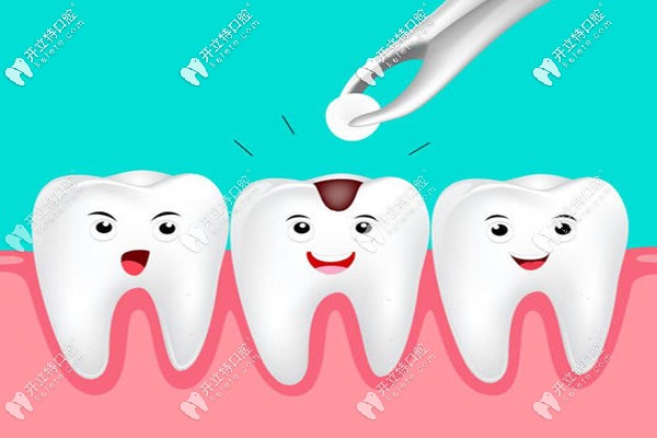 玉林口腔醫(yī)院補牙價格表